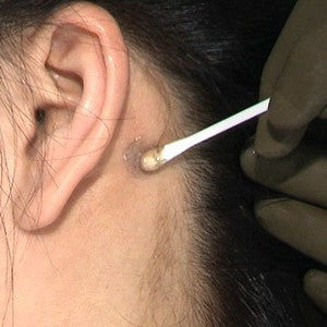 Home Skin Test Kit